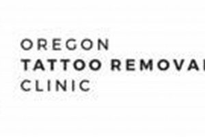 Affordable Tattoo Removal Portland Oregon: Find Relief Now! Safem Fabrication - Precision Engineering & Custom Manufacturing Solutions Affordable Tattoo Removal Portland Oregon: Find Relief Now! | Safem Fabrication - Precision Engineering & Custom Manufacturing Solutions