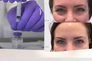 Botox Salem Oregon Safem Fabrication - Precision Engineering & Custom Manufacturing Solutions Botox Salem Oregon | Safem Fabrication - Precision Engineering & Custom Manufacturing Solutions