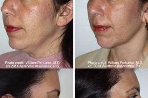 Neck Lift Portland Oregon Living in Oregon: Moving Tips, Cost of Living & Best Cities Neck Lift Portland Oregon | Living in Oregon: Moving Tips, Cost of Living & Best Cities