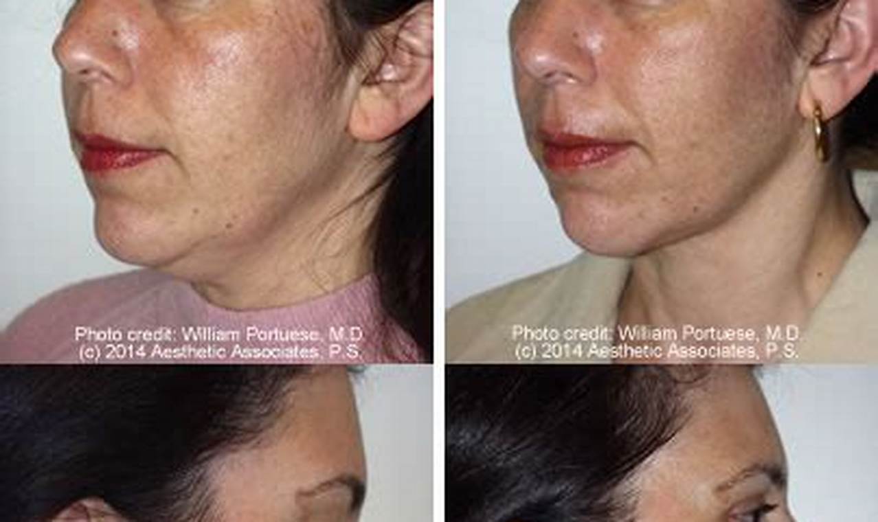 Neck Lift Portland Oregon Living in Oregon: Moving Tips, Cost of Living & Best Cities Neck Lift Portland Oregon | Living in Oregon: Moving Tips, Cost of Living & Best Cities
