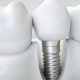 Top Rated Dental Implants Portland Oregon Experts | Living in Oregon: Moving Tips, Cost of Living & Best Cities