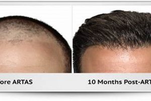 Hair Implants Portland Oregon Living in Oregon: Moving Tips, Cost of Living & Best Cities Hair Implants Portland Oregon | Living in Oregon: Moving Tips, Cost of Living & Best Cities