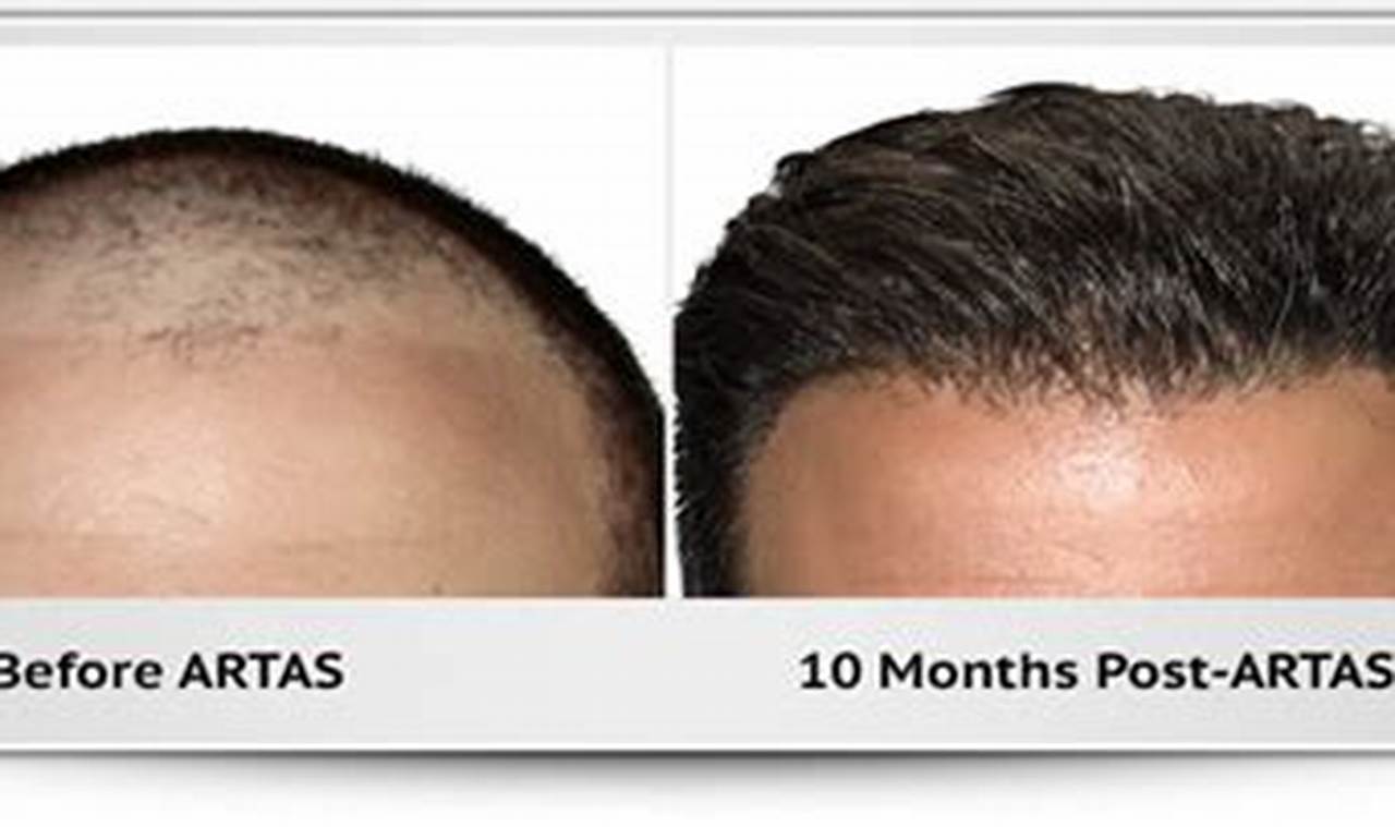 Hair Implants Portland Oregon Living in Oregon: Moving Tips, Cost of Living & Best Cities Hair Implants Portland Oregon | Living in Oregon: Moving Tips, Cost of Living & Best Cities