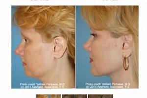 Liposuction Portland Oregon Living in Oregon: Moving Tips, Cost of Living & Best Cities Liposuction Portland Oregon | Living in Oregon: Moving Tips, Cost of Living & Best Cities