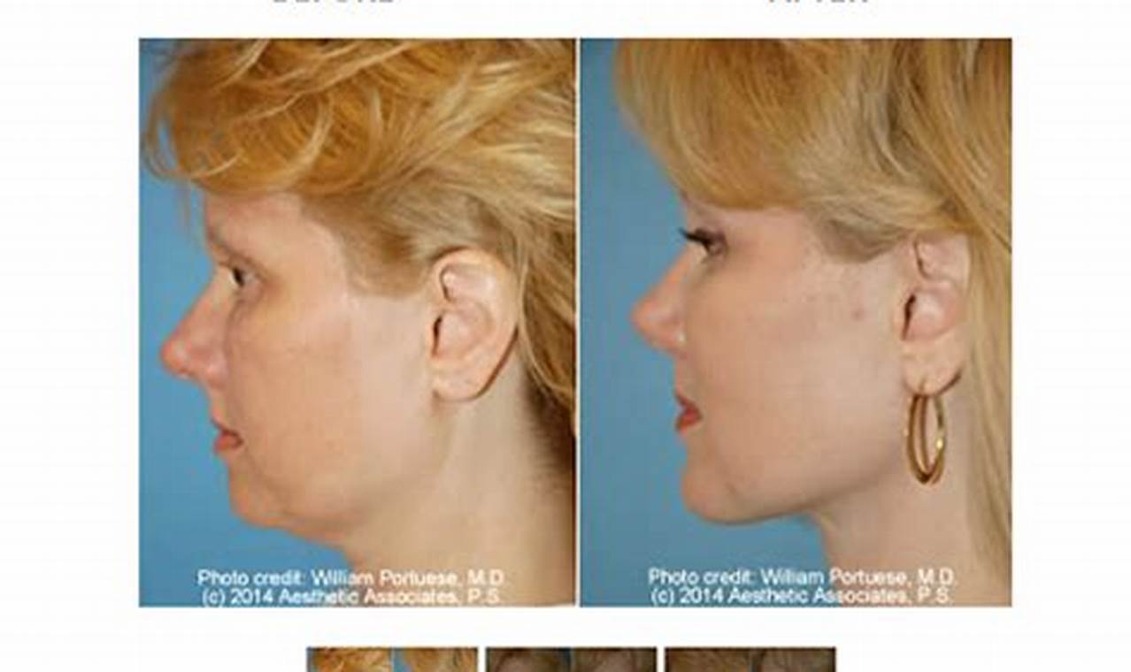 Liposuction Portland Oregon Living in Oregon: Moving Tips, Cost of Living & Best Cities Liposuction Portland Oregon | Living in Oregon: Moving Tips, Cost of Living & Best Cities