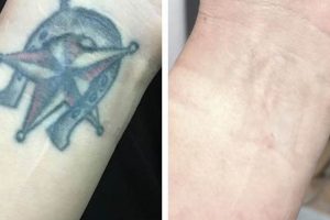 Affordable Tattoo Removal Portland Oregon: Find Relief Now! Living in Oregon: Moving Tips, Cost of Living & Best Cities Affordable Tattoo Removal Portland Oregon: Find Relief Now! | Living in Oregon: Moving Tips, Cost of Living & Best Cities