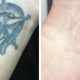 Affordable Tattoo Removal Portland Oregon: Find Relief Now! | Living in Oregon: Moving Tips, Cost of Living & Best Cities