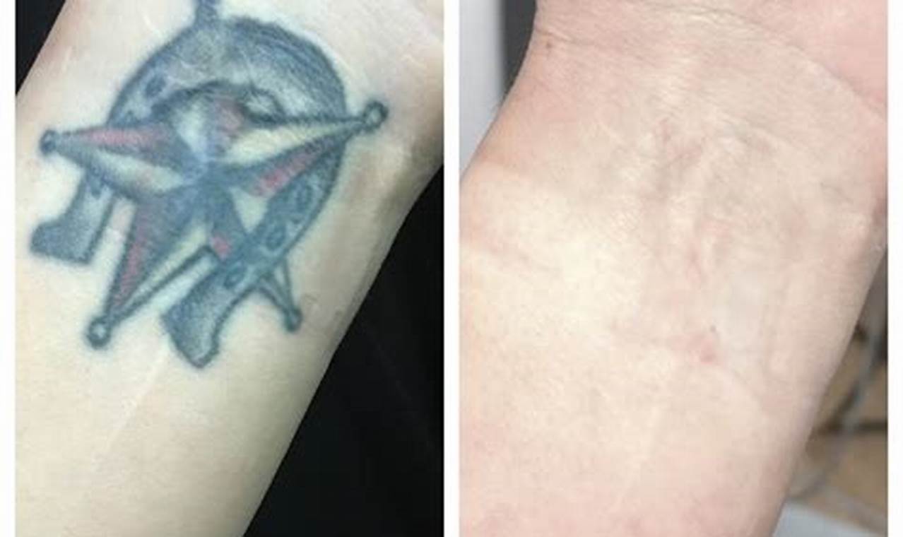 Affordable Tattoo Removal Portland Oregon: Find Relief Now! Living in Oregon: Moving Tips, Cost of Living & Best Cities Affordable Tattoo Removal Portland Oregon: Find Relief Now! | Living in Oregon: Moving Tips, Cost of Living & Best Cities