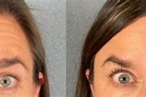 Botox in Eugene, OR: Find Top Providers & Prices | Living in Oregon: Moving Tips, Cost of Living & Best Cities